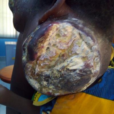 Restore Mission In Ghana Since 2014 4 20171017 1572124747