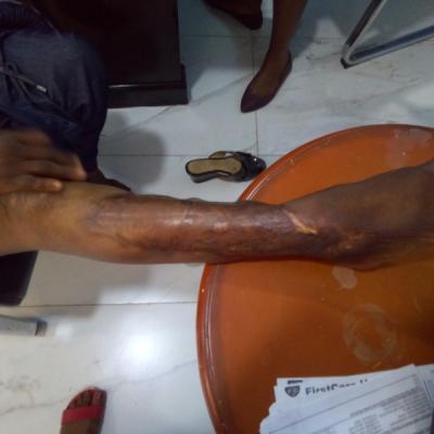 Restore Mission In Ghana Since 2014 9 20171017 1169658164